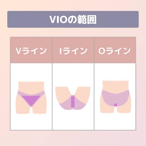 VIOの範囲を記した図