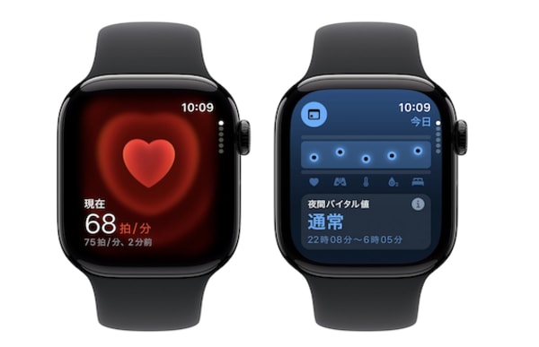 Apple Watch Series 10